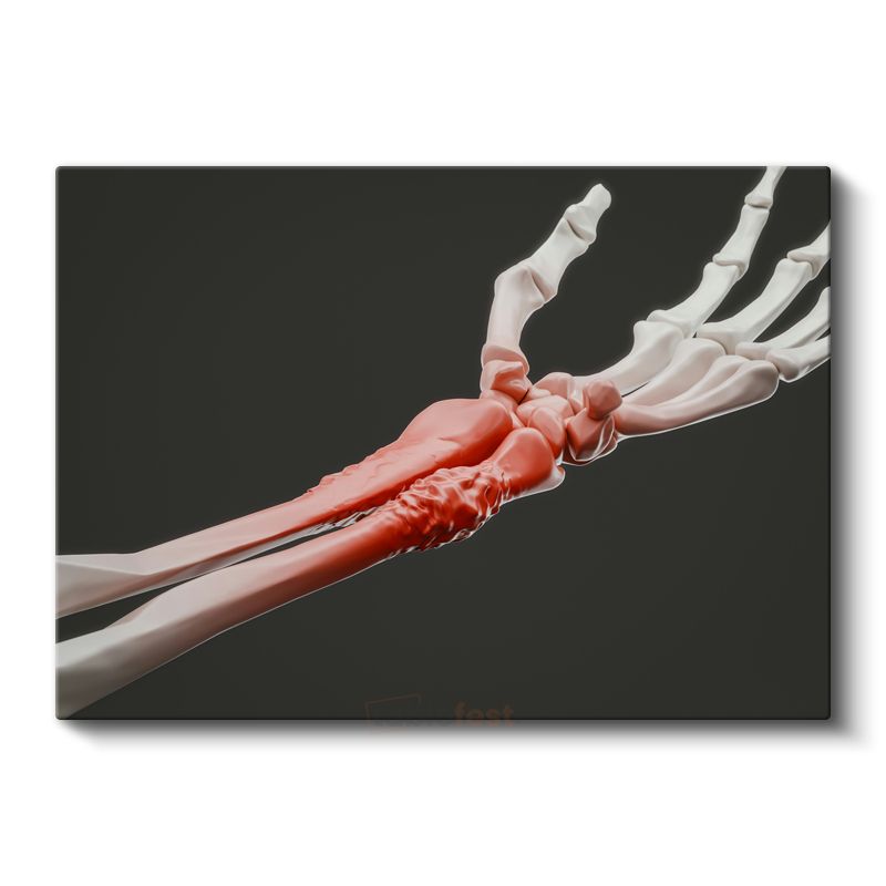 Ortopedi Uzmanı - Kemik Anatomisi Kanvas Tablo