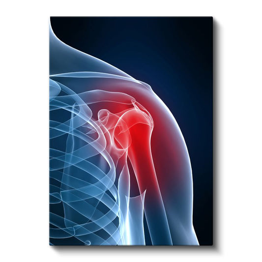 Ortopedist - Omuz Anatomisi Kanvas Tablo