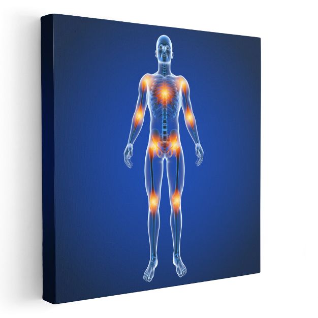 Ortopedist - Eklem Ağrıları ve Tedavi Kanvas Tablo