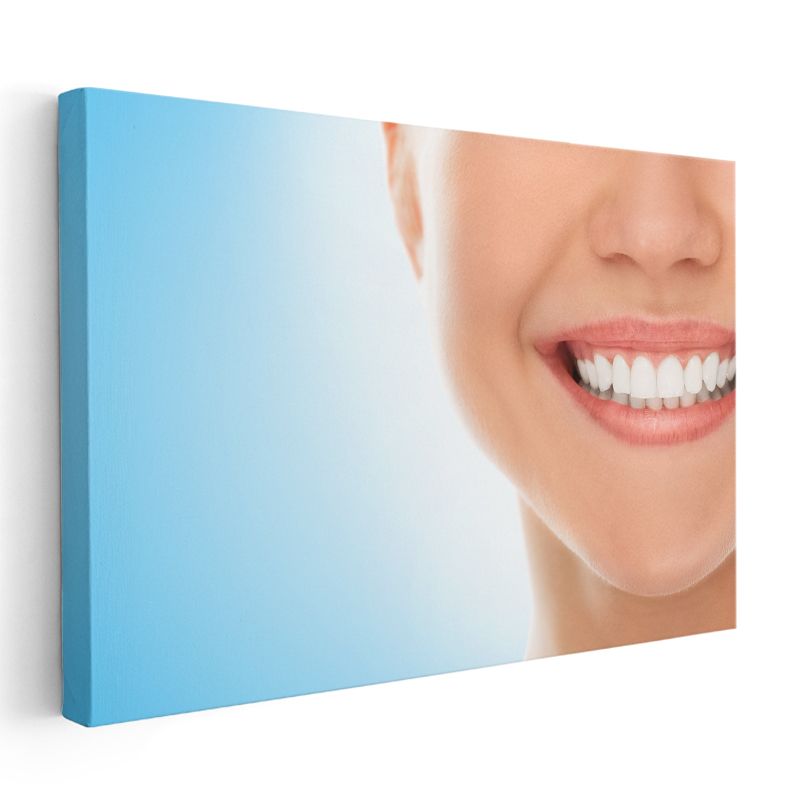 Diş Hekimi - Kozmetik Diş Hekimliği ve Gülüş Estetiği Kanvas Tablo