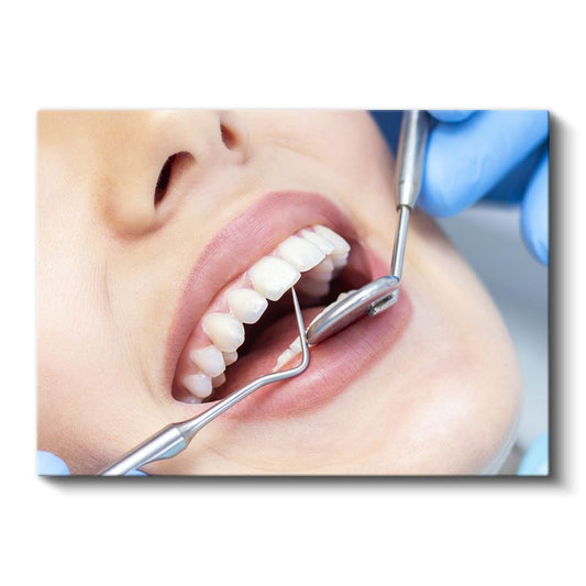 Diş Hekimi - Ağız Bakımı Kontrolü Kanvas Tablo