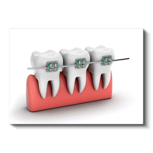 Ortodontist - Çağdaş Diş Teli Sistemleri ve Tedavi Yöntemleri Kanvas Tablo