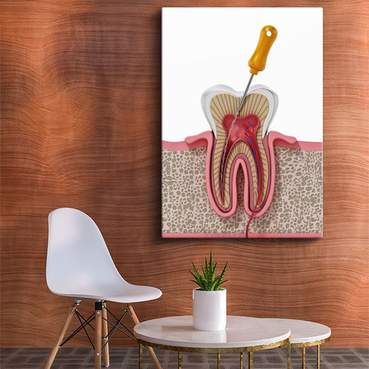 Diş Hekimi - Kök Kanal Tedavisi ve Diş Anatomisi Kanvas Tablo