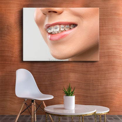Ortodontist - Gülüş Tasarımı Kanvas Tablo