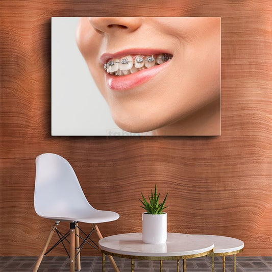 Ortodontist - Gülüş Tasarımı Kanvas Tablo