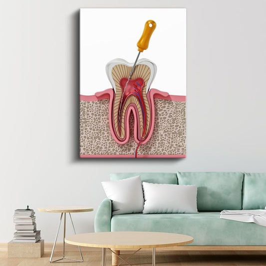 Diş Hekimi - Kök Kanal Tedavisi ve Diş Anatomisi Kanvas Tablo