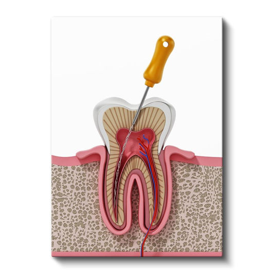 Diş Hekimi - Kök Kanal Tedavisi ve Diş Anatomisi Kanvas Tablo