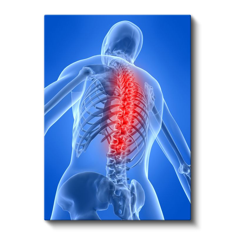 Ortopedi Uzmanı - Omurga ve Sinir Sistemi Kanvas Tablo