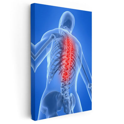 Ortopedi Uzmanı - Omurga ve Sinir Sistemi Kanvas Tablo