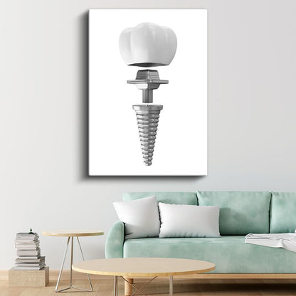 Diş Protez Uzmanı - İmplant Sistemi Kanvas Tablo