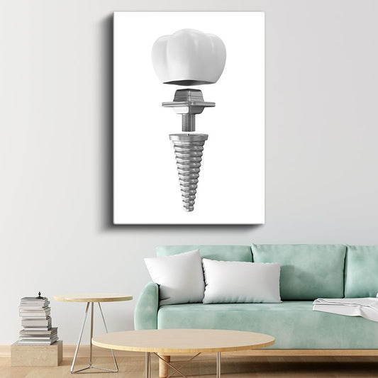 Diş Protez Uzmanı - İmplant Sistemi Kanvas Tablo
