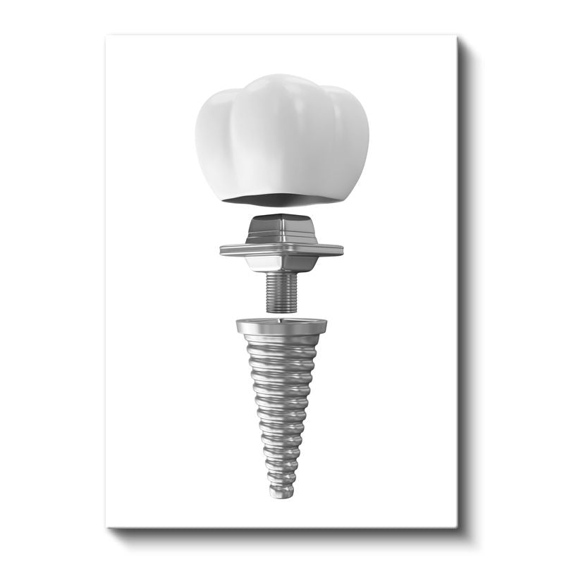Diş Protez Uzmanı - İmplant Sistemi Kanvas Tablo