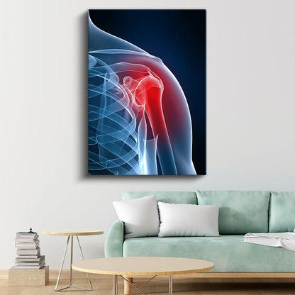 Ortopedist - Omuz Anatomisi Kanvas Tablo