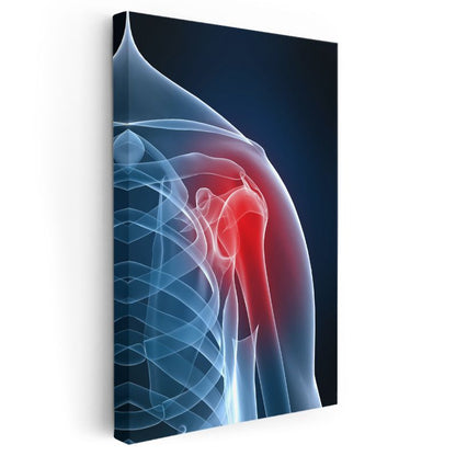 Ortopedist - Omuz Anatomisi Kanvas Tablo