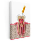 Dikey Kanvas Tablo Diş Kökü Kanal Tedavisi Kesiti Diş Hekimi Tablosu Ev Ofis Duvar Dekoru