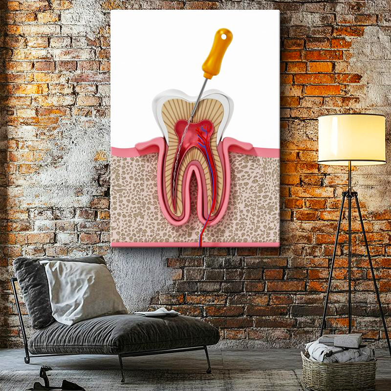 Dikey Kanvas Tablo Diş Kökü Kanal Tedavisi Kesiti Diş Hekimi Tablosu Ev Ofis Duvar Dekoru