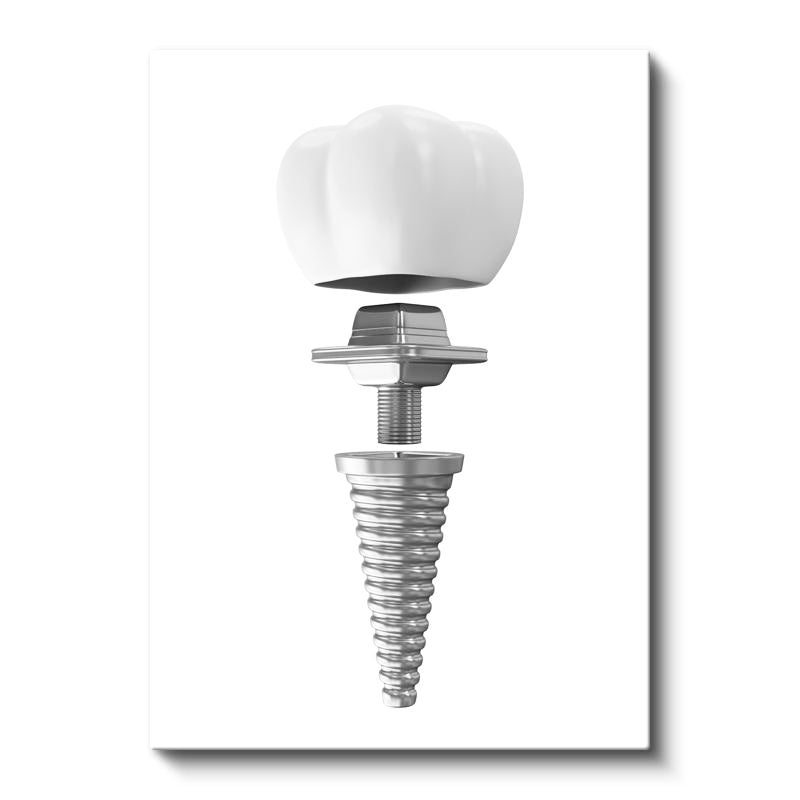 Dikey Kanvas Tablo Dental İmplant Parçaları Diş Hekimi Tablosu Ev Ofis Duvar Dekoru