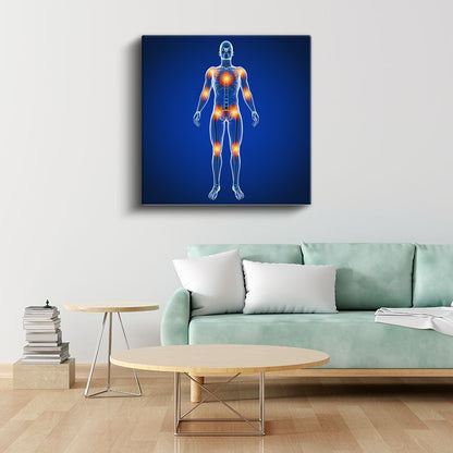 Ortopedist - Eklem Ağrıları ve Tedavi Kanvas Tablo