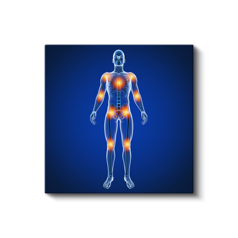 Ortopedist - Eklem Ağrıları ve Tedavi Kanvas Tablo