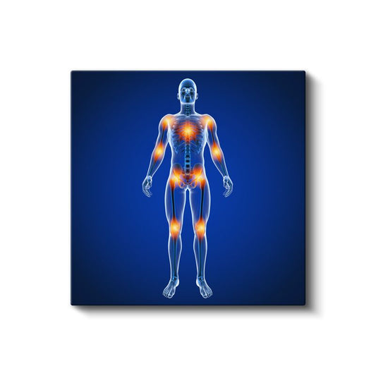 Ortopedist - Eklem Ağrıları ve Tedavi Kanvas Tablo