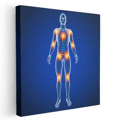 Ortopedist - Eklem Ağrıları ve Tedavi Kanvas Tablo