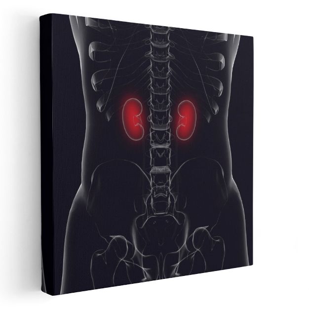 Nefrolog - Böbrek Anatomisi ve Fonksiyonu Kanvas Tablo