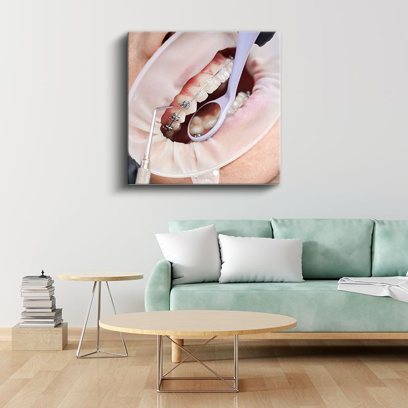 Ortodontist - Diş Teli Uygulaması ve Tedavi Süreci Kanvas Tablo