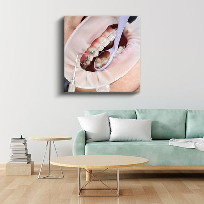 Ortodontist - Diş Teli Uygulaması ve Tedavi Süreci Kanvas Tablo