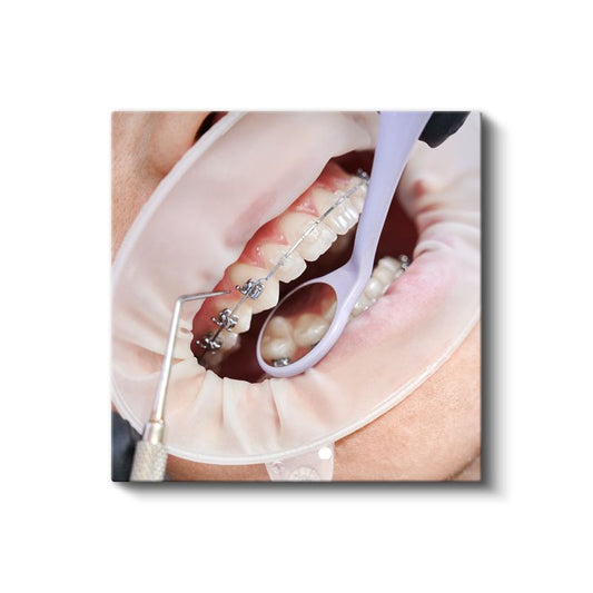 Ortodontist - Diş Teli Uygulaması ve Tedavi Süreci Kanvas Tablo
