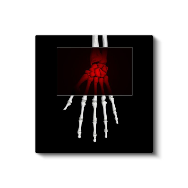 Radyolog - Kemik Yapısı İncelemesi Kanvas Tablo