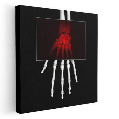 Radyolog - Kemik Yapısı İncelemesi Kanvas Tablo