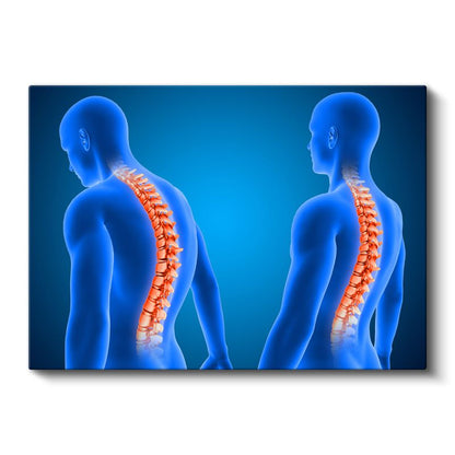 Fizyoterapist - Omurga Sağlığı Kanvas Tablo