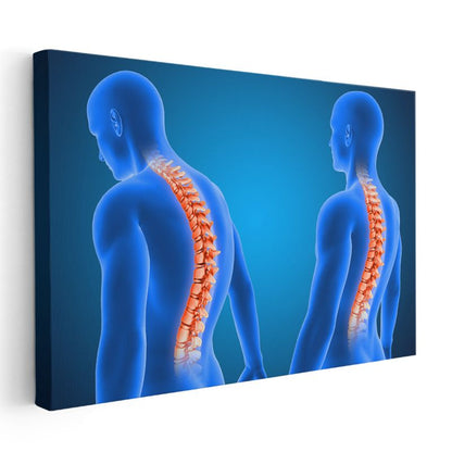 Fizyoterapist - Omurga Sağlığı Kanvas Tablo