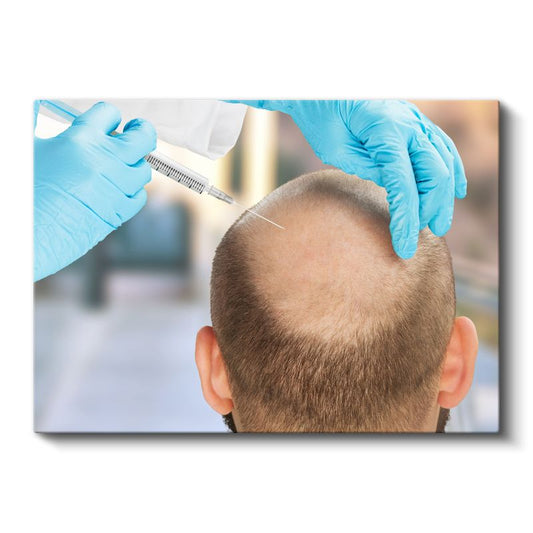 Saç Ekimi Uzmanı - Saç Restorasyonu Kanvas Tablo