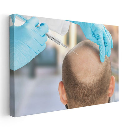 Saç Ekimi Uzmanı - Saç Restorasyonu Kanvas Tablo