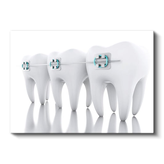 Ortodontist - Modern Ortodonti Teknikleri Kanvas Tablo