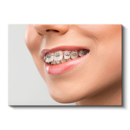 Ortodontist - Gülüş Tasarımı Kanvas Tablo