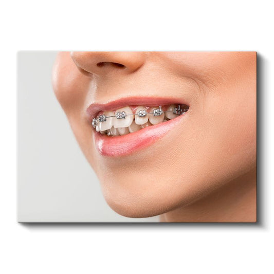 Ortodontist - Gülüş Tasarımı Kanvas Tablo