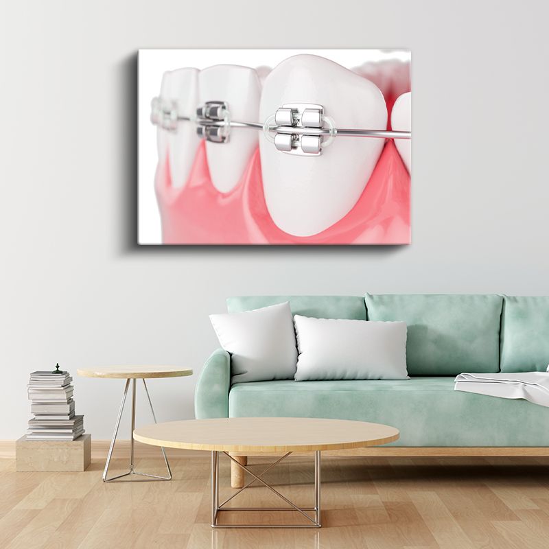 Ortodontist - İleri Ortodonti Uygulamaları Kanvas Tablo