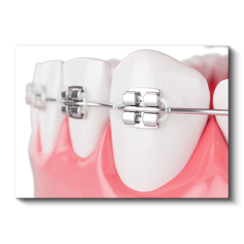 Ortodontist - İleri Ortodonti Uygulamaları Kanvas Tablo