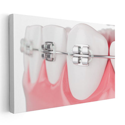 Ortodontist - İleri Ortodonti Uygulamaları Kanvas Tablo