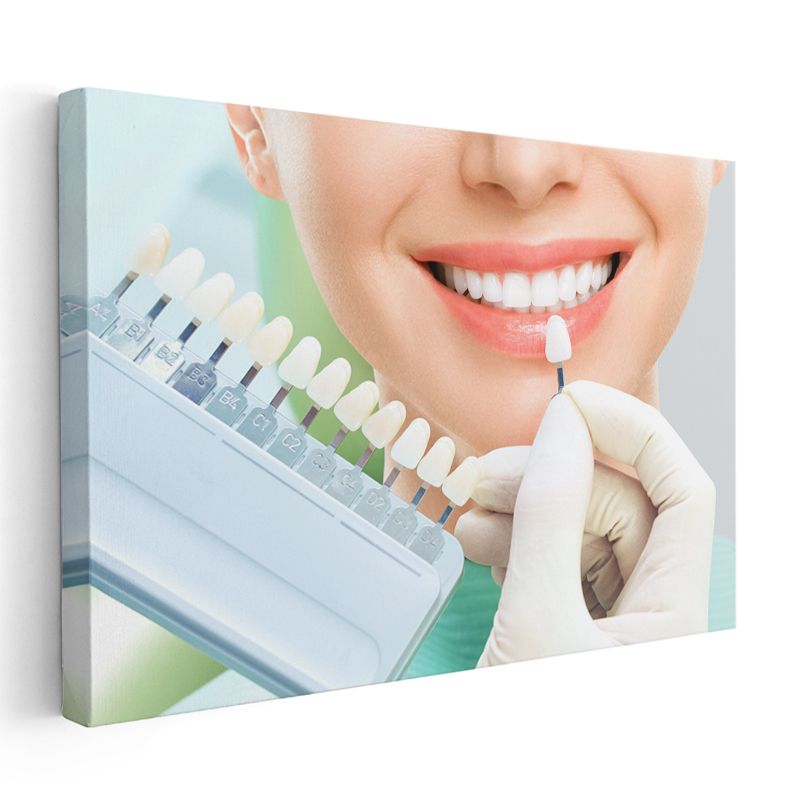 Diş Hekimi - Profesyonel Diş Beyazlatma ve Bleaching Tedavisi Kanvas Tablo