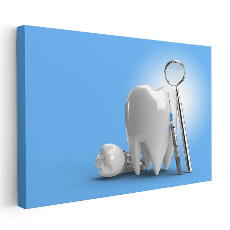 Diş Hekimi - İmplant Tedavisi Aletleri Kanvas Tablo