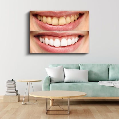 Diş Hekimi - Modern Diş Beyazlatma Teknikleri ve Uygulamaları Kanvas Tablo