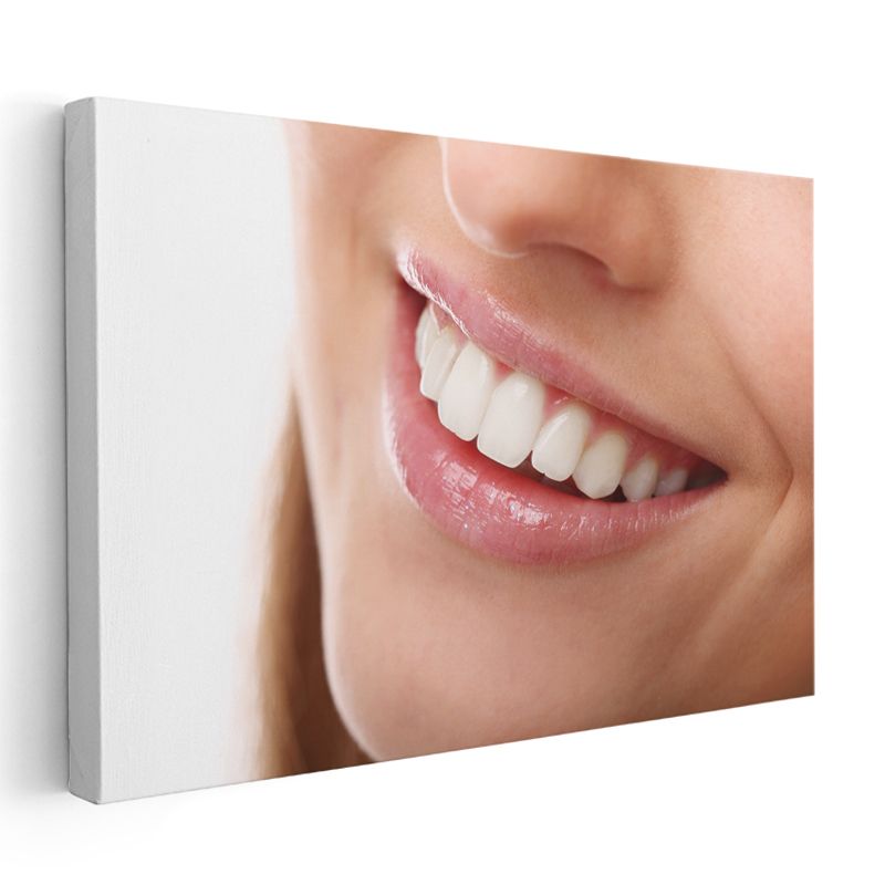 Diş Hekimi - Profesyonel Gülüş Tasarımı ve Estetik Diş Hekimliği Kanvas Tablo