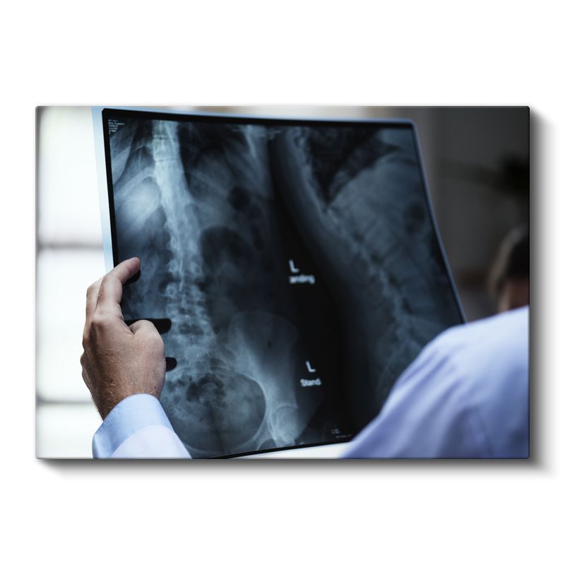 Radyolog - Tıbbi Görüntüleme Analizi Kanvas Tablo