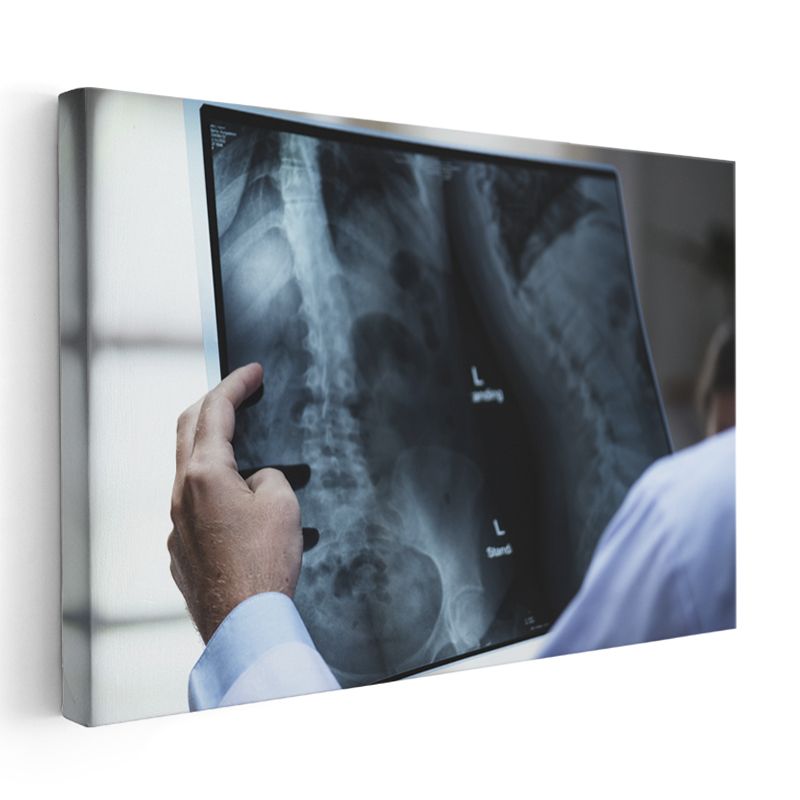 Radyolog - Tıbbi Görüntüleme Analizi Kanvas Tablo