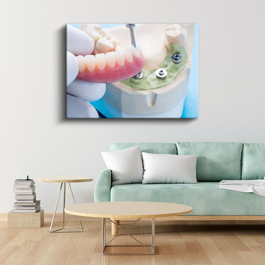 Diş Hekimi - İmplant Yerleştirme Tekniği Kanvas Tablo