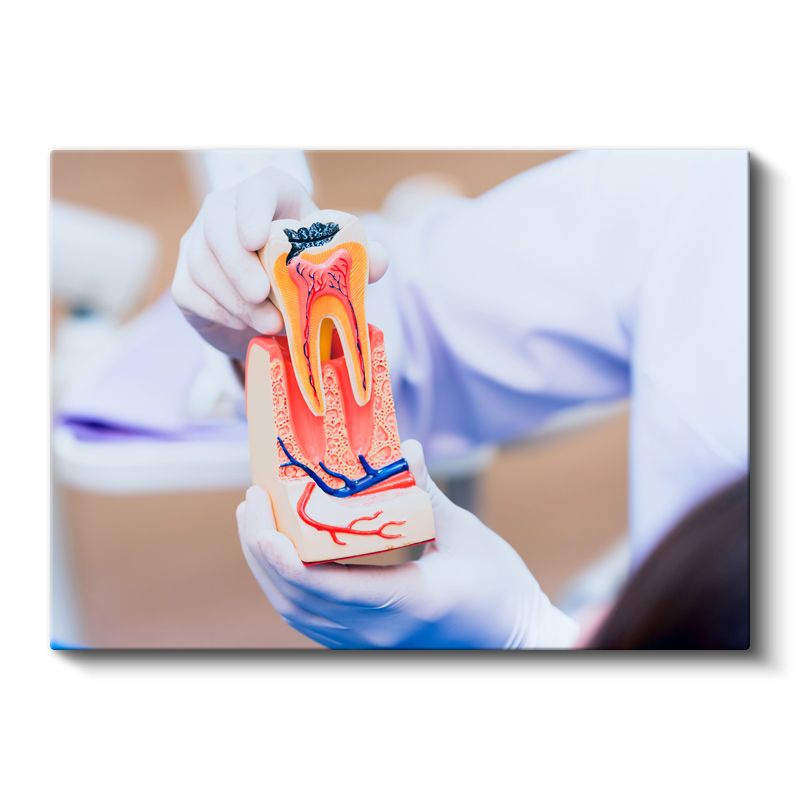 Diş Hekimi - Diş Anatomisi Eğitimi Kanvas Tablo
