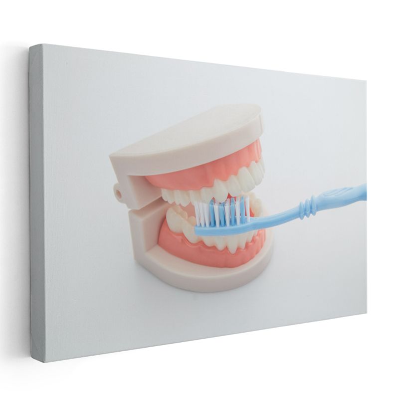 Diş Teknisyeni - Diş Protez Modeli Kanvas Tablo